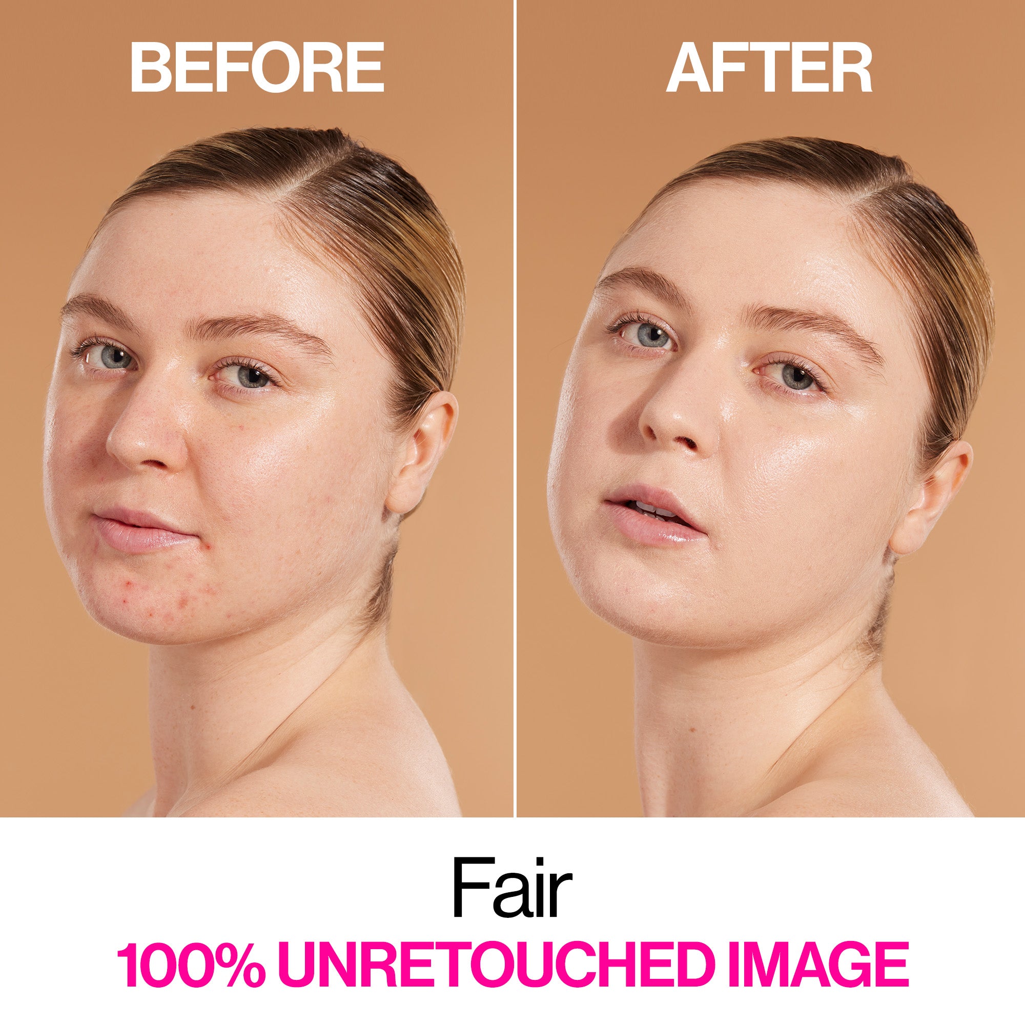 Bare Focus Niacinamide Skin Tint | Fair - Image 3
