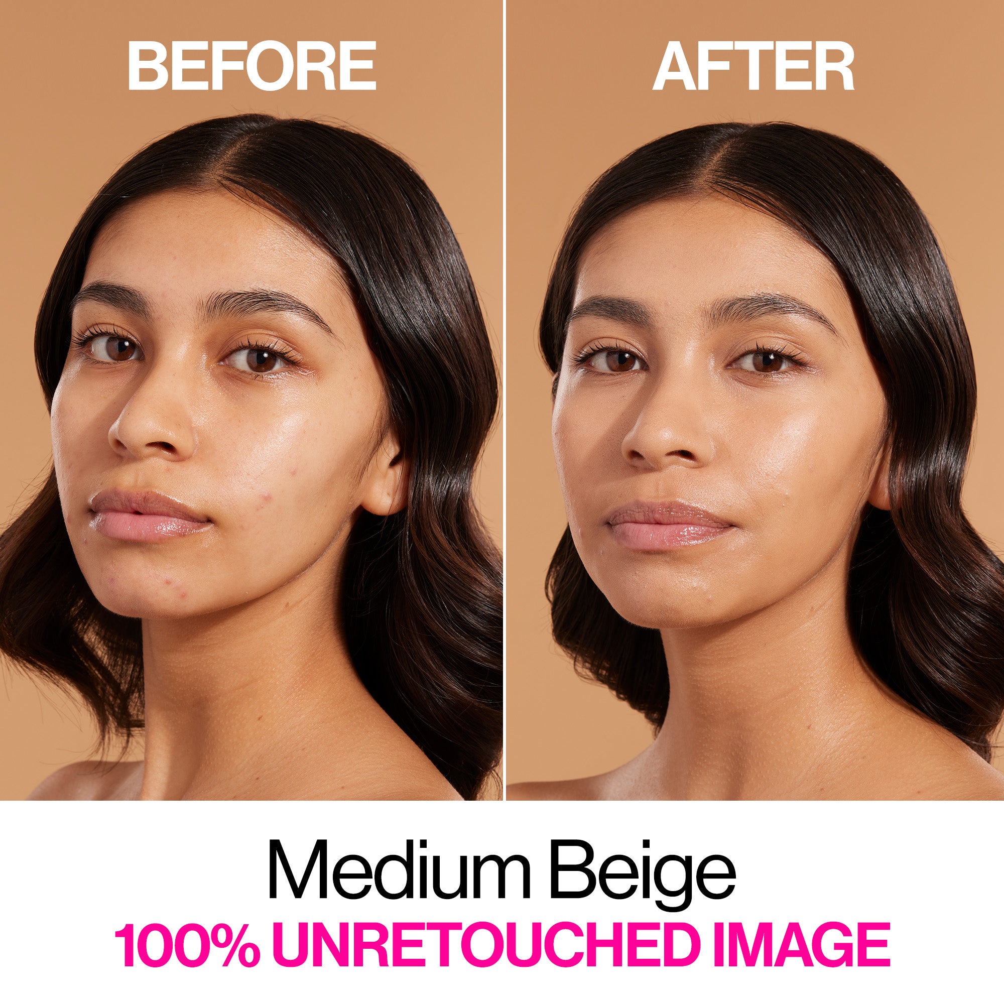 Bare Focus Niacinamide Skin Tint | Medium Beige - Image 3